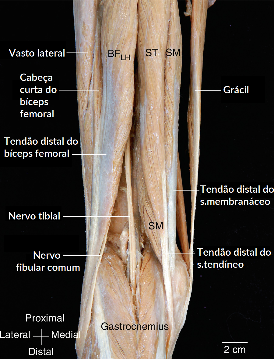 Lesões nos Isquiotibiais: anatomia da parte posterior da coxa.
